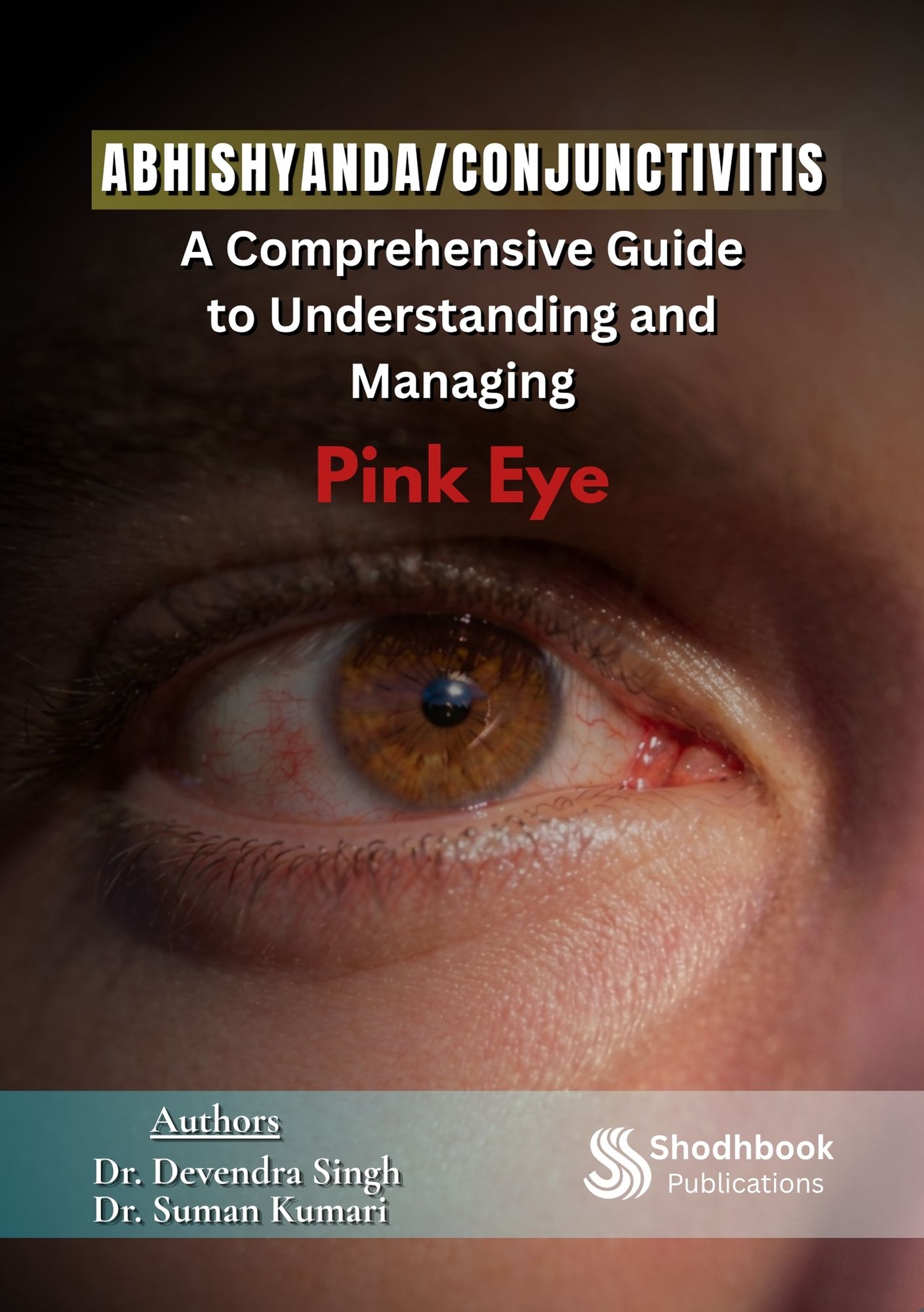 Abhishyanda/Conjunctivitis: A Comprehensive Guide to Understanding and Managing Pink Eye
